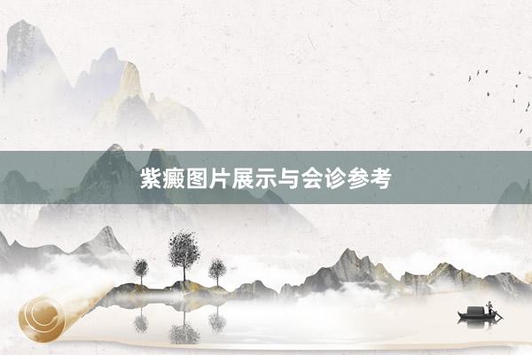 紫癜图片展示与会诊参考